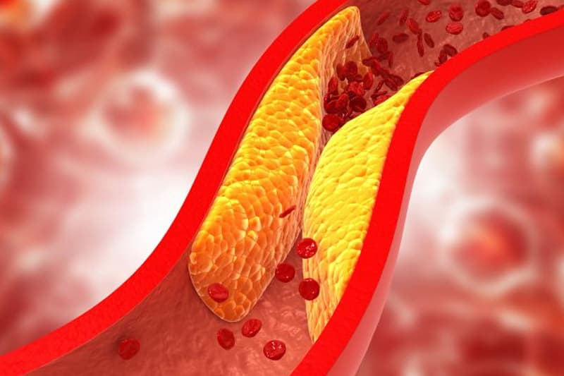 කොලස්ට්රොල් පිළිබඳ ඇත්ත කතාව - (වීඩියෝ)