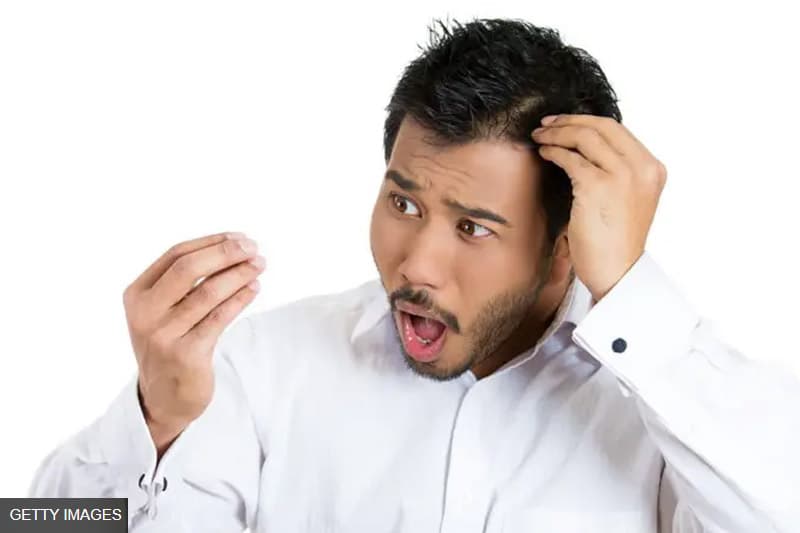 හිසකෙස් ගැලවී යාම නවත්වන්න පුළුවන් ද?