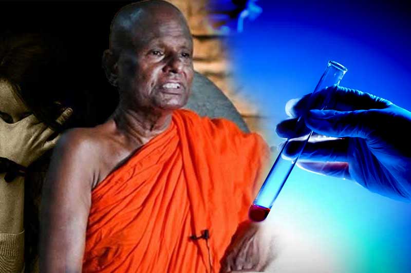 බාලවයස්කාර දැරියක අපයෝජන සිද්ධිය: DNA පරීක්ෂණය සඳහා පල්ලේගම හේමරතන හිමිගෙන් රුධිර සාම්පල ගනී