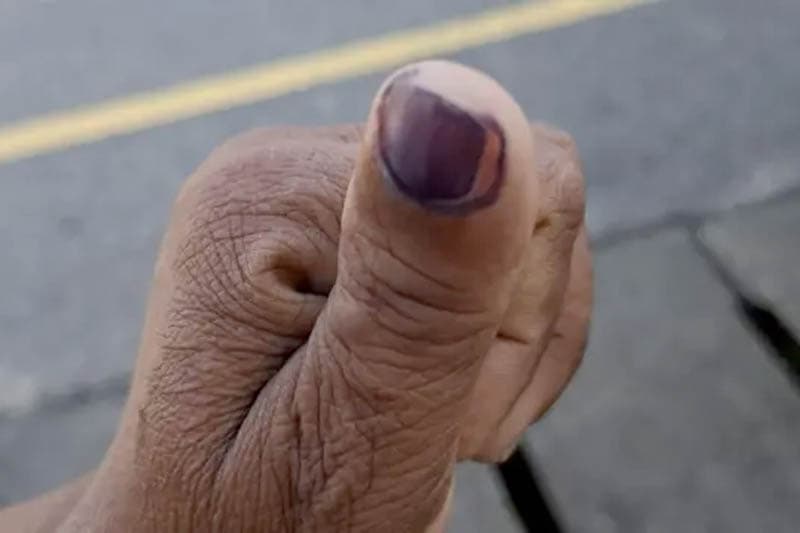 ඇල්පිටියේ මොකද වුනේ? - (පිලිප් ශාන්ත)