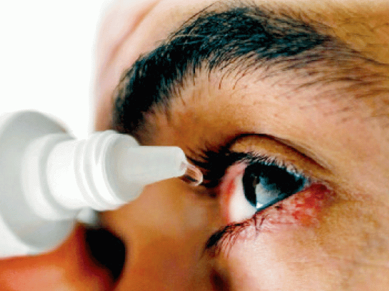 eye