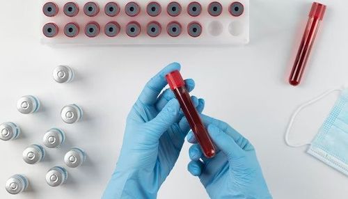 small Himoglobin 0fd22d4cbe