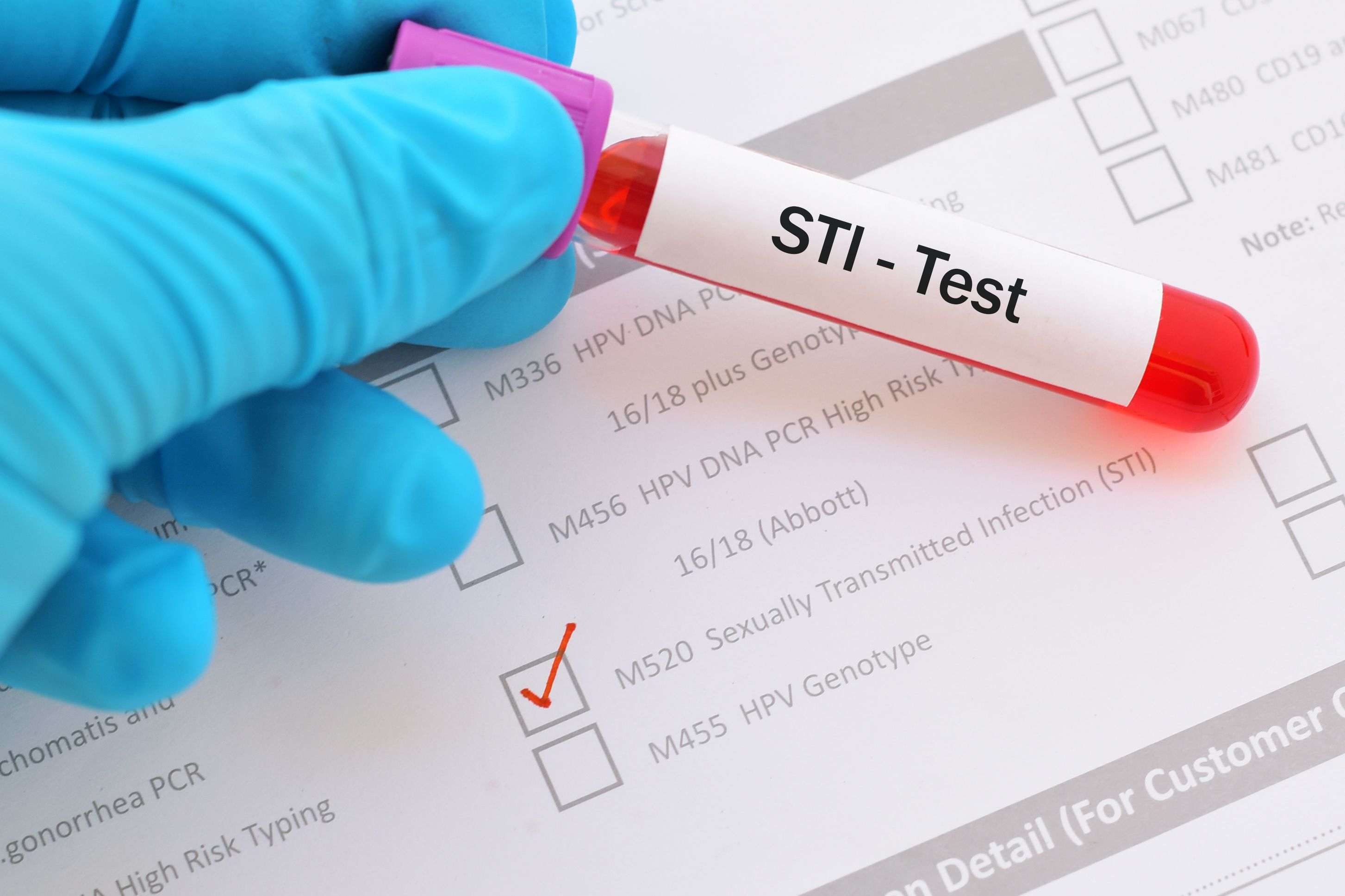 what to expect from an sti health check 1537873684