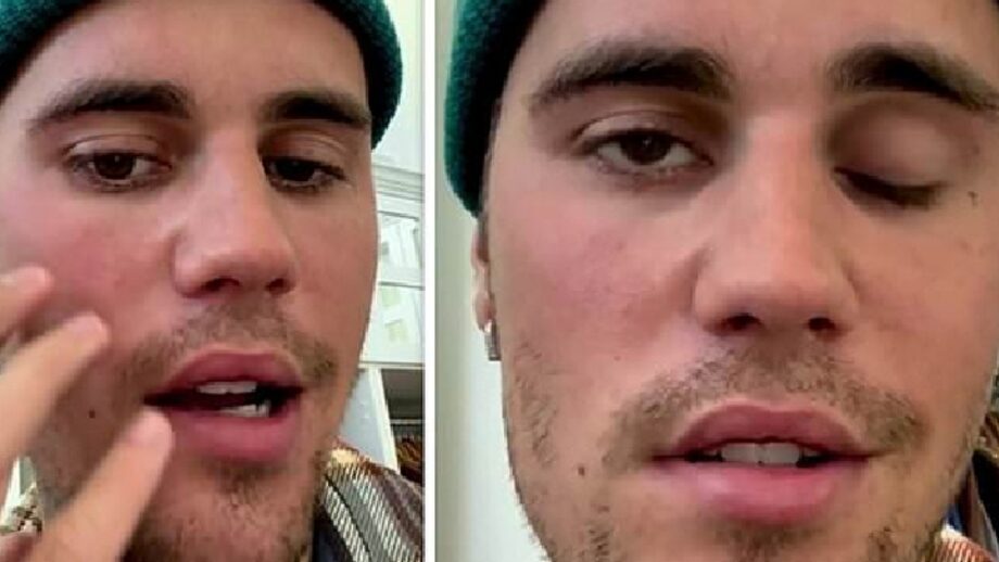 sad news justin bieber is suffering from ramsay hunt syndrome reveals right side of face is paralysed 920x518
